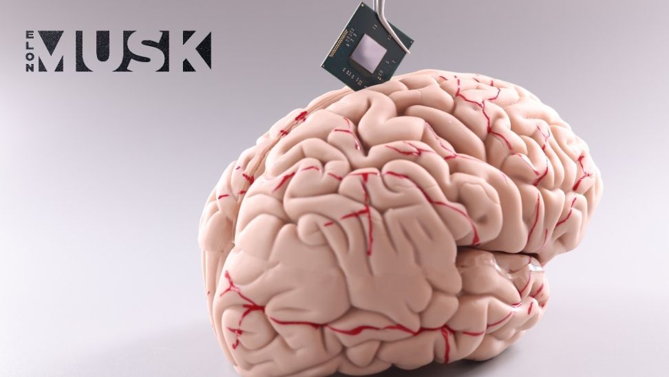 beyin çipi takılan hasta düşünce gücüyle satranç oynadı