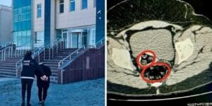 İran uyruklu kadın yolcunun makatında uyuşturucu yakalandı