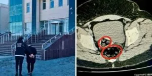 İran uyruklu kadın yolcunun makatında uyuşturucu yakalandı