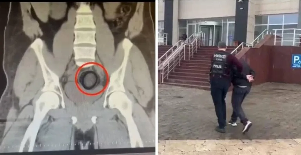 Kars’ta uluslararası uyuşturucu madde ticareti yapan kurye yakalandı – Birlik Haber Ajansı