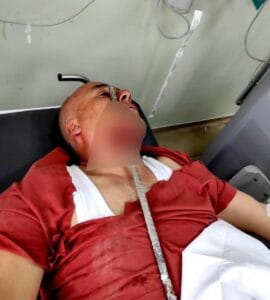 Yüzüne demir saplanan işçi ölümden döndü – Birlik Haber Ajansı