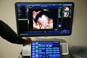 Kars’ta 4 boyutlu ultrason dönemi başladı! – Birlik Haber Ajansı