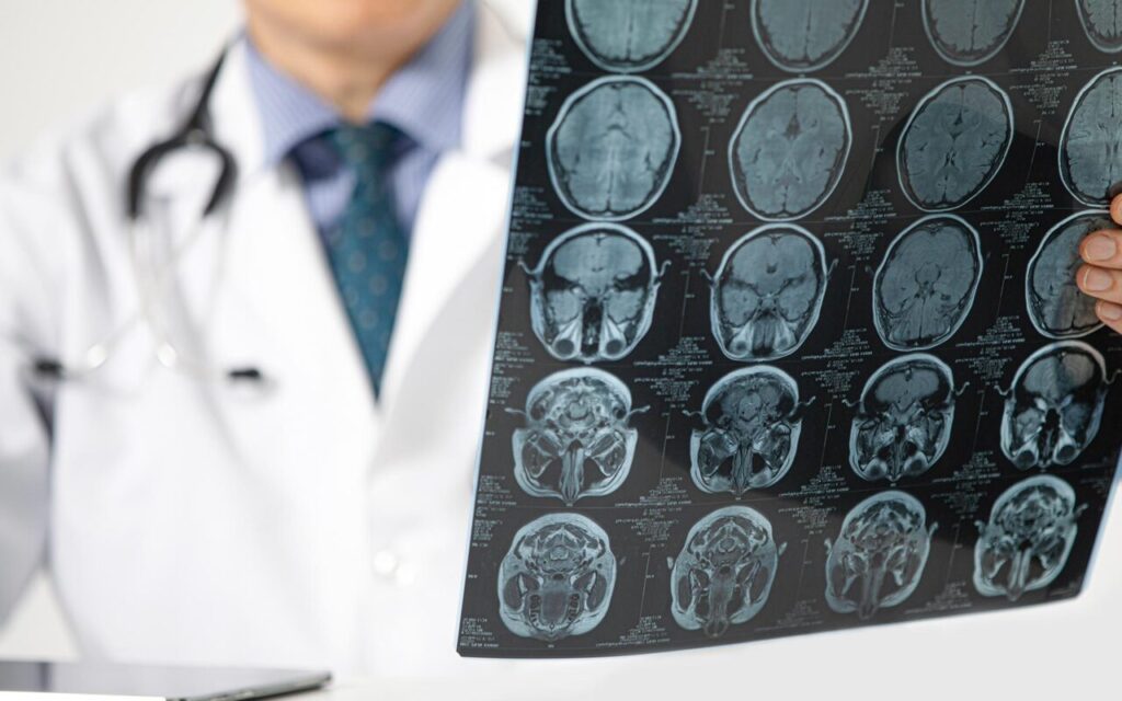 Genetik kodda gizli tehlike: Erkeklerde demans riski yükseliyor – Birlik Haber Ajansı