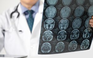 Genetik kodda gizli tehlike: Erkeklerde demans riski yükseliyor – Birlik Haber Ajansı