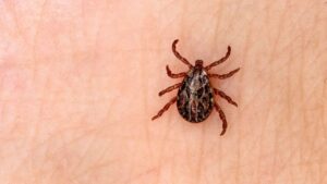 Tokat’ta KKKA şüphesiyle tedavi gören kadın hayatını kaybetti – Birlik Haber Ajansı