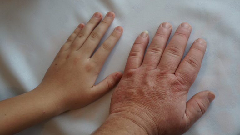 İnsan uzuvları yeniden büyüyebilir mi? Cevap Axolotl’da gizli – Birlik Haber Ajansı