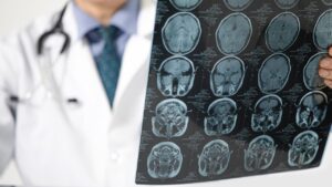 Pandemi beyni yaşlandırdı: Covid olmasanız bile etkilenmiş olabilirsiniz – Birlik Haber Ajansı