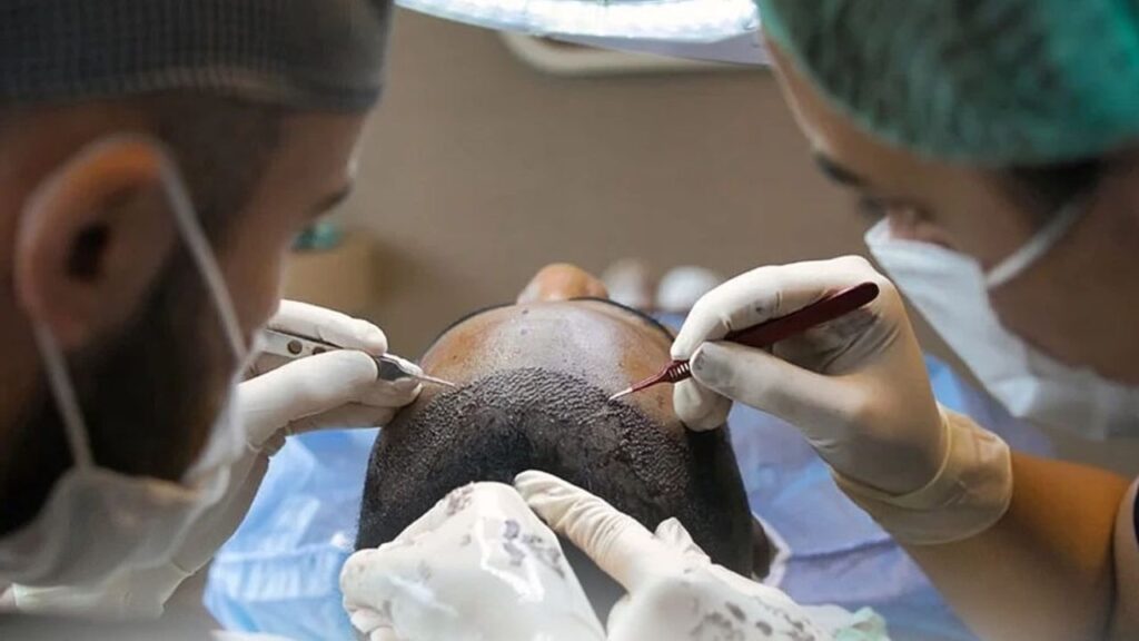 Sağlık Bakanlığı’ndan saç ekimi birimlerinde yeni dönem – Birlik Haber Ajansı